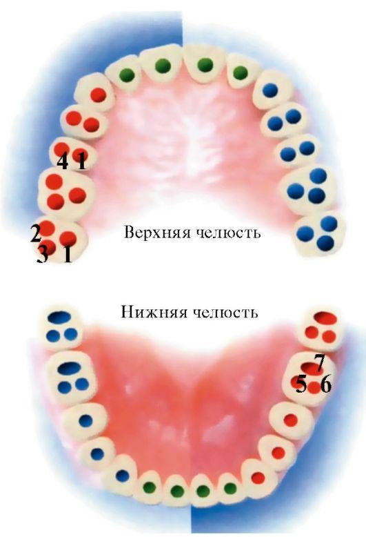 46 зуб анатомия каналов Импланты MIS 7 Seven Томск Таежный