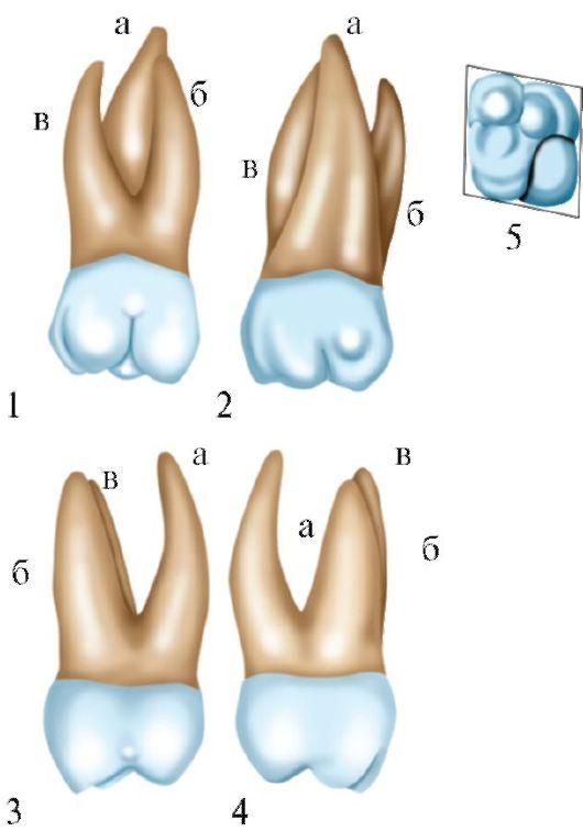 Зуб 1.4. Первый моляр верхней челюсти. 1 Моляр верхней челюсти анатомия. 1 Моляр верхней челюсти корни. Зуб второй моляр верхней челюсти.