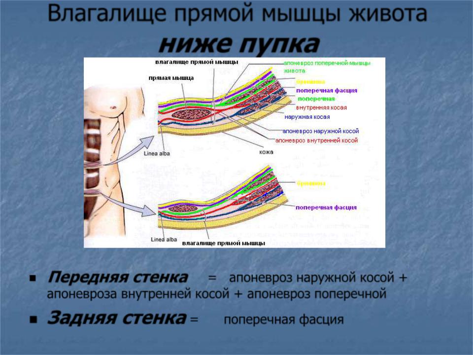 Мышцы передней брюшной стенки живота. Топография влагалища прямой мышцы живота. Слои мышц передней брюшной стенки живота. Переднебоковая стенка живота мышцы. Строение влагалища прямой мышцы живота анатомия.