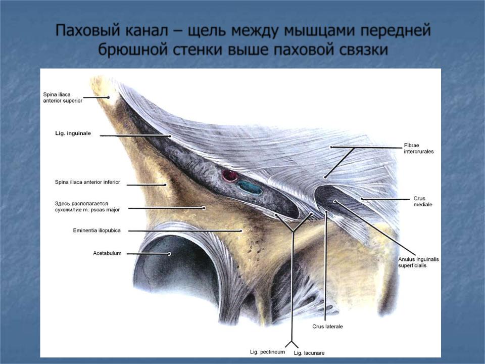 Пращевидная связка. Строение пахового канала анатомия. Паховая связка и подвздошно лобковый тракт. Паховый канал и сосудистая лакуна.