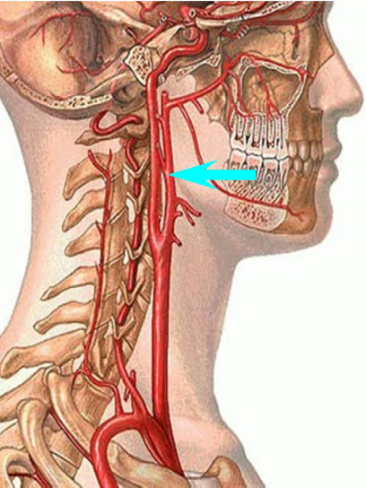 Сонные артерии на шее человека фото. Яремная Вена Сонная Сонная артерия. Сонная артерия и яремная Вена. Сонный артиреля на шеи.