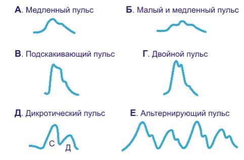 Виды пульса