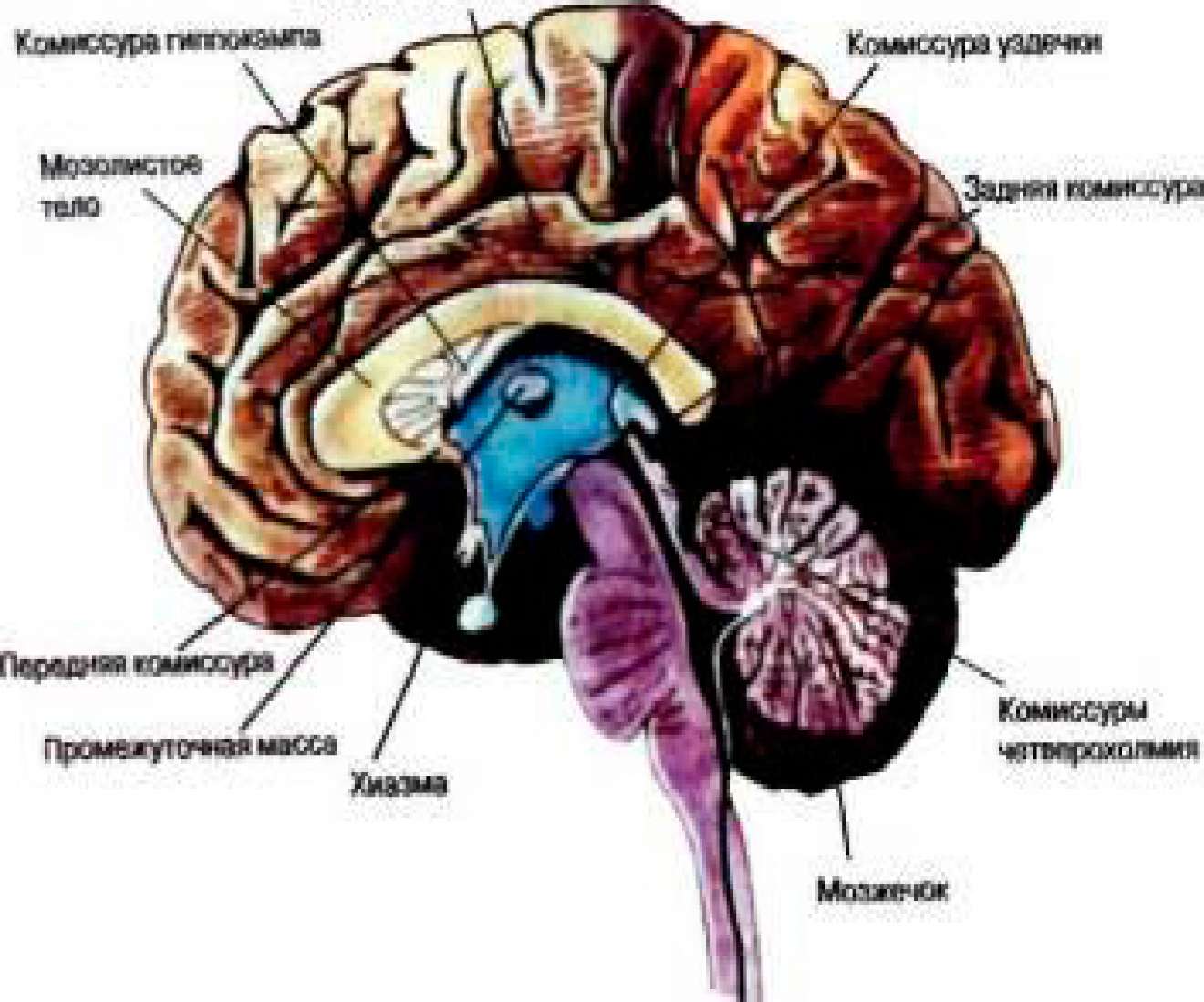 Диэнцефальная дисфункция головного мозга. Строение головного мозга. Комиссуры головного мозга. Диэнцефальные структуры головного мозга. Диэнцефальные отделы мозга это.