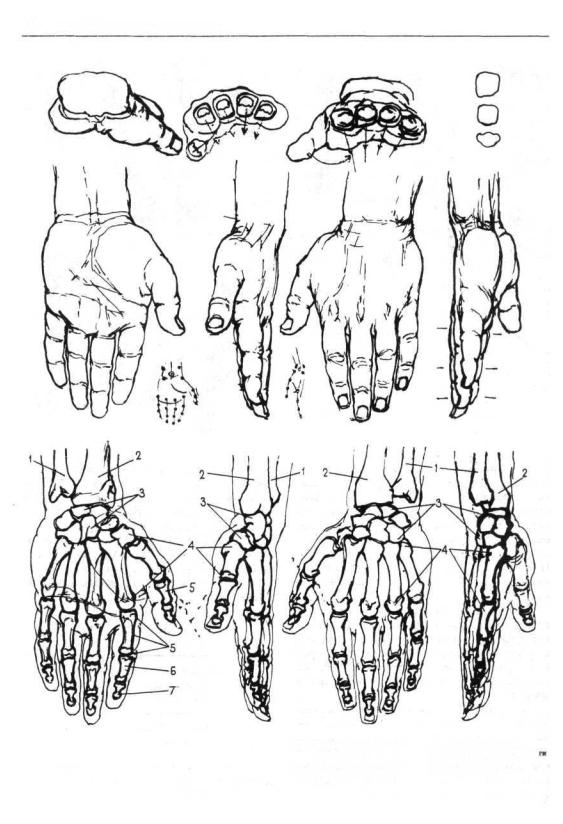 Кости кисти анатомия рисунок
