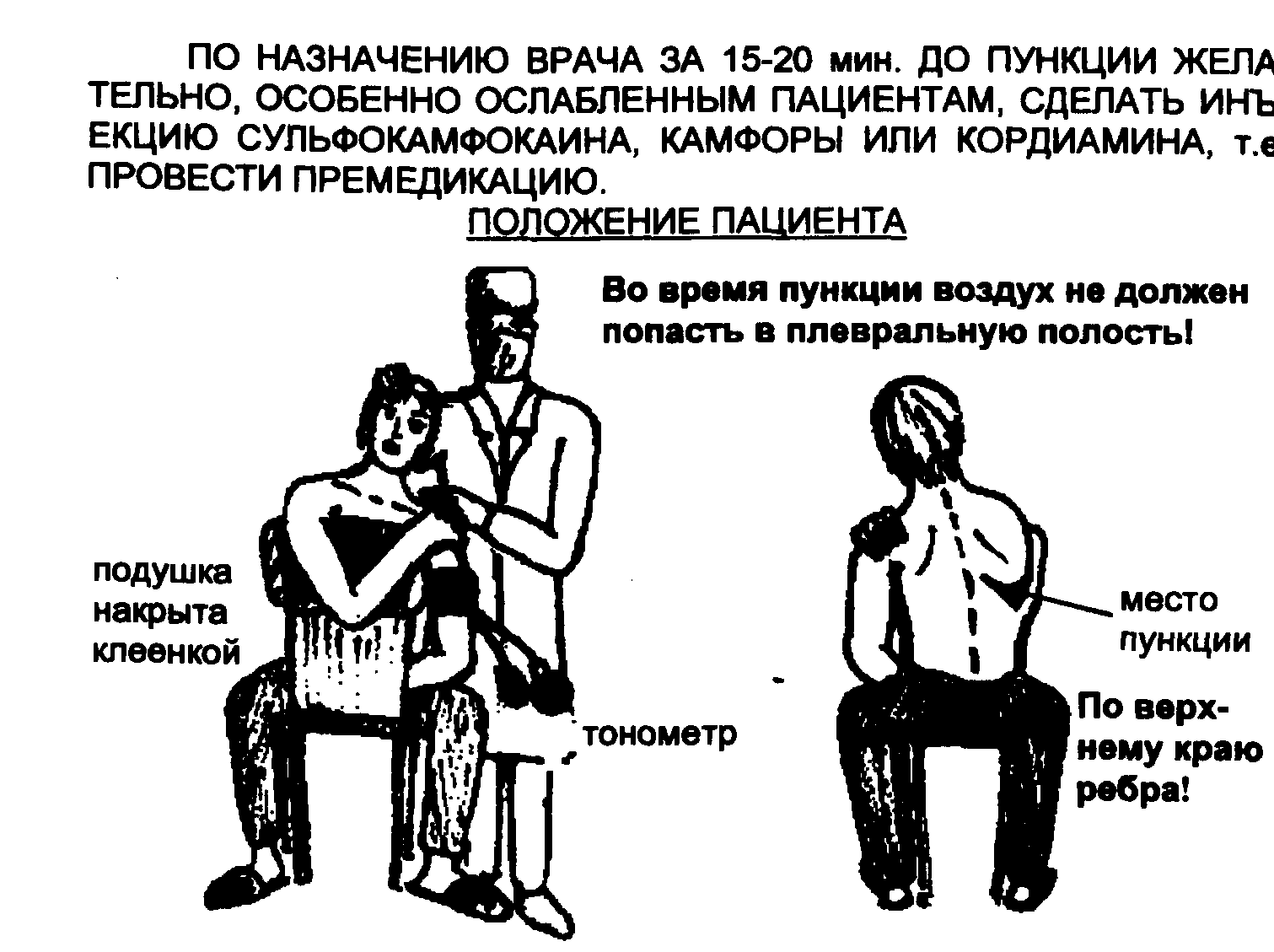 Техника выполнения плевральной пункции. Подготовка и ассистирование при плевральной пункции. Подготовка пациента к плевральной пункции. Подготовка больного к плевральной пункции. Памятка подготовка пациента к плевральной пункции.