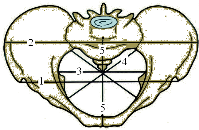 Акушерские размеры таза на рисунке