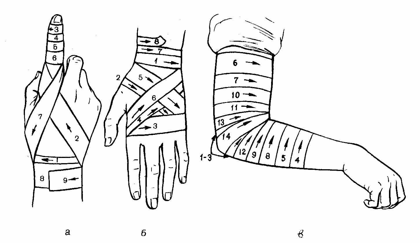 Схемы бинтования рук