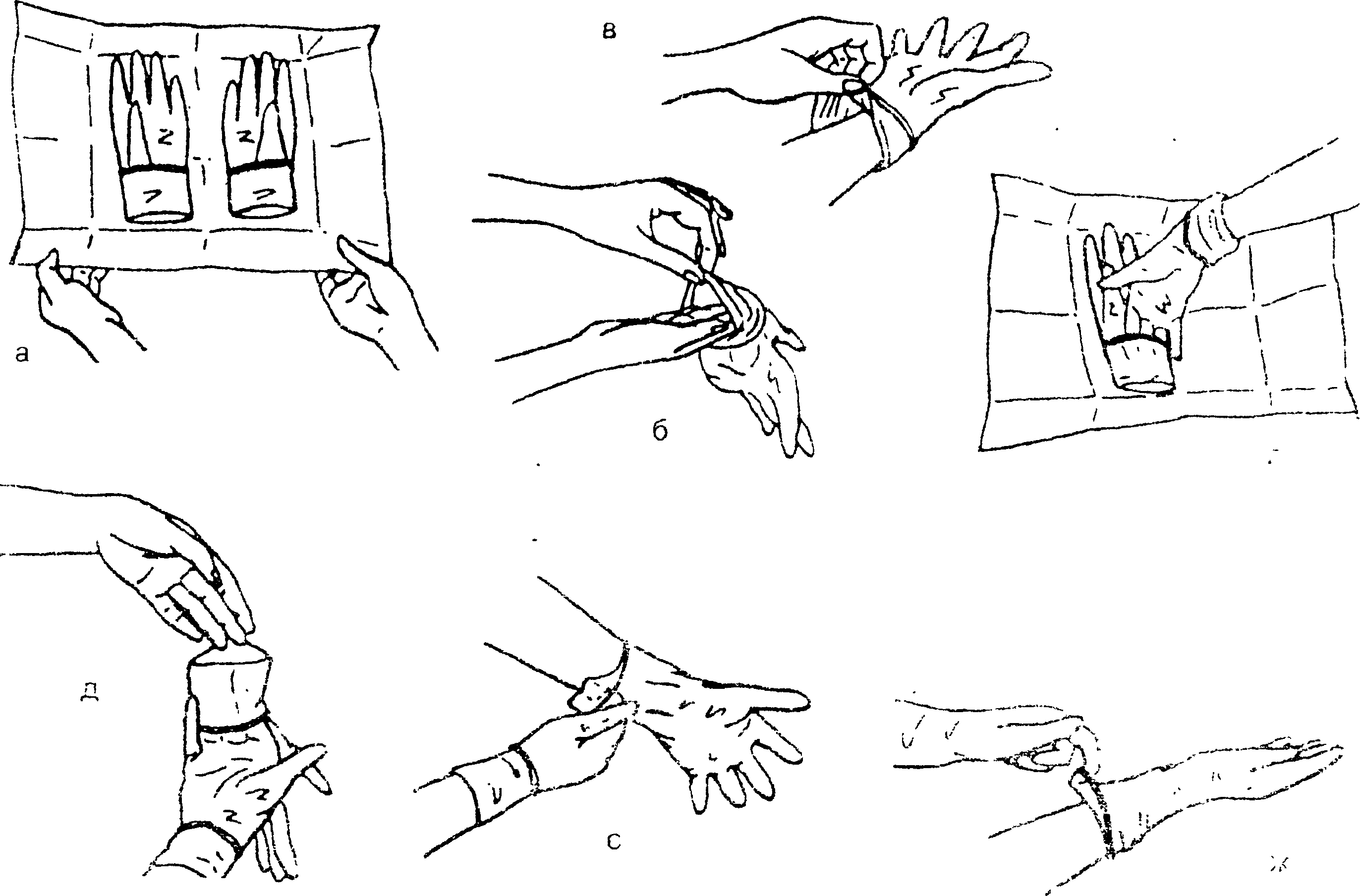 Алгоритм стерильных перчаток. Надевание стерильных перчаток алгоритм. Техника одевания стерильных перчаток. Одевание стерильных перчаток алгоритм. Одевание стерильных перчаток на хирурга алгоритм.
