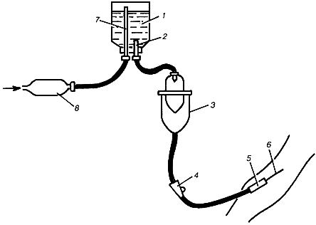 Капельница медицинская устройство схема