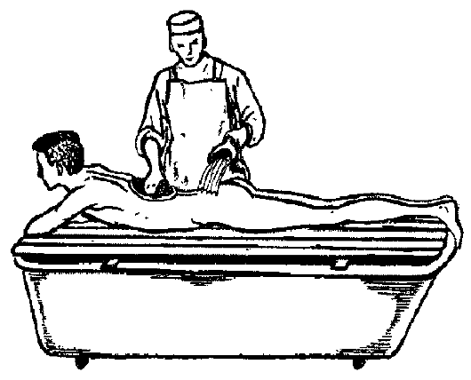 Санитарная обработка больного (гигиеническая ванна):. Гигиеническая ванна для тяжелобольных. Проведение гигиенической ванны пациенту. Мытье тяжелобольного пациента.