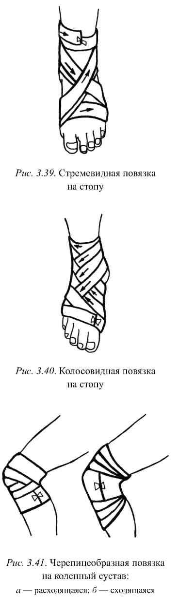 Наложение повязок на различные области тела при кровотечении