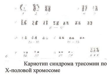 Хромосомные болезни классификация и синдромы