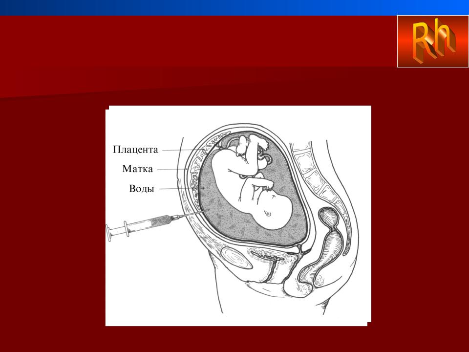 22 неделе плацента. Ребенок в плаценте матке. Плацента матка пуповина.