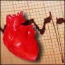 Лекции по внутренним болезням инфаркт миокарда thumbnail