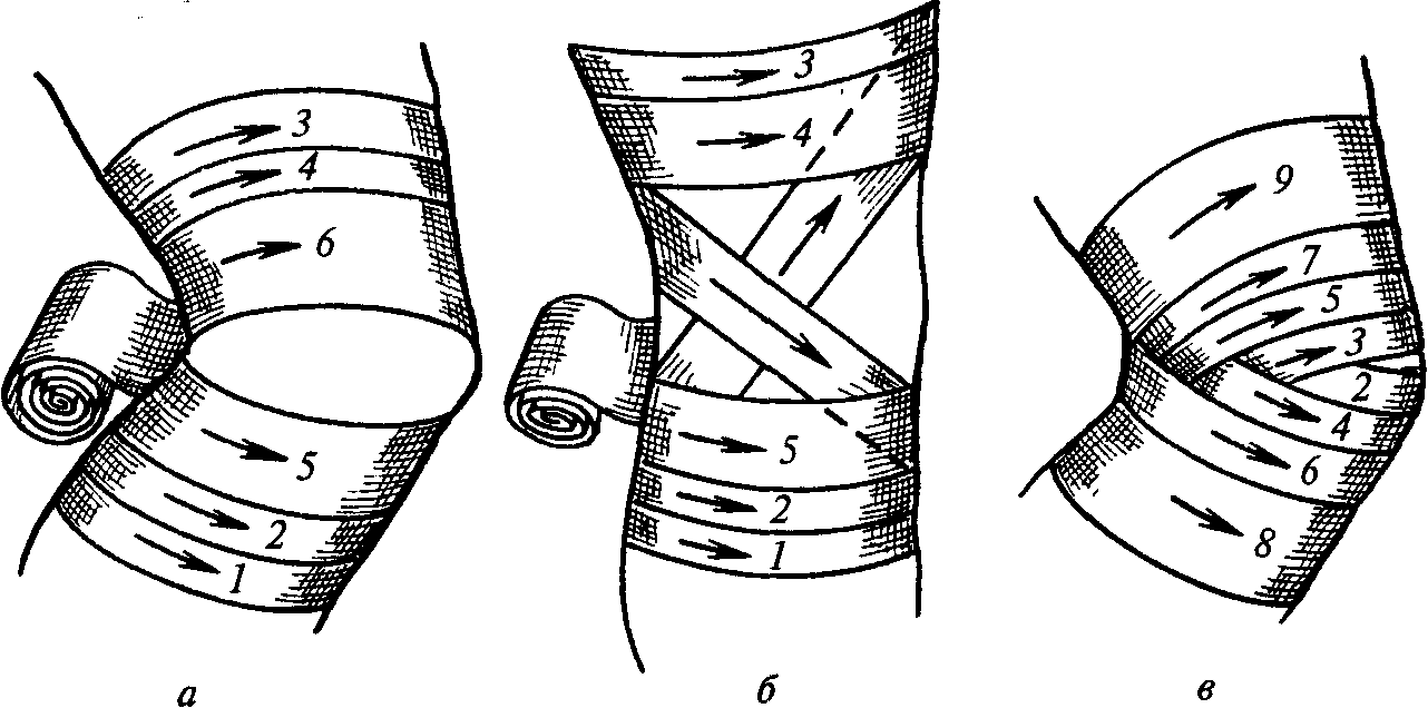 Как правильно забинтовать эластичным бинтом