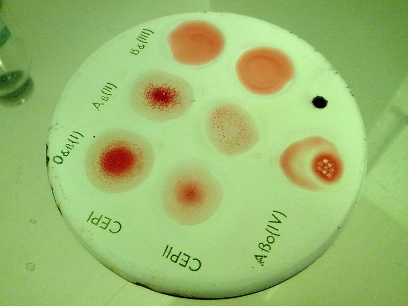 Резус фактор обезьян. Чашка Петри для определения группы крови. Тарелочка для определения группы крови. Планшет для определения группы крови. Группа крови.
