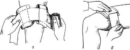 Наложение окклюзионной повязки при пневмотораксе