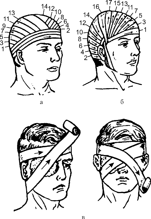 Перевязана голова бинтом фото