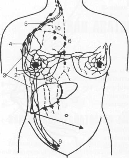 Лимфоузлы грудной клетки расположение у женщин фото