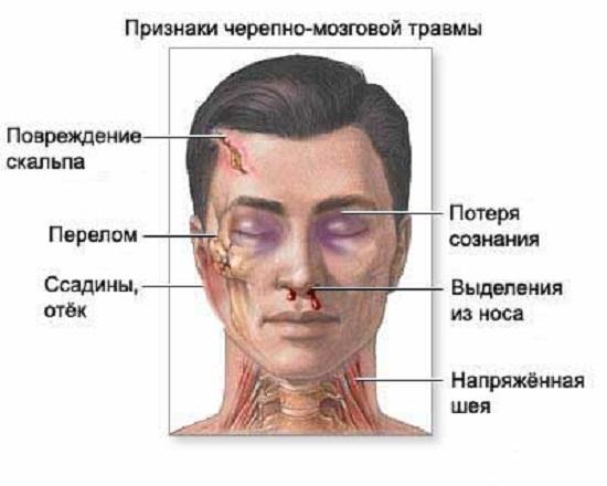 Перелом свода и основания черепа отличия Перелом свода и основания черепа отличия thumbnail