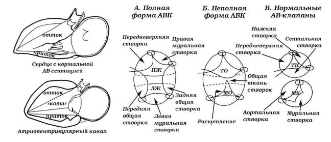 Открытый атриовентрикулярный канал презентация