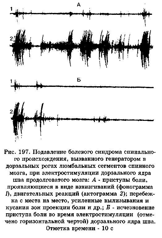 Генератор патологически усиленного возбуждения