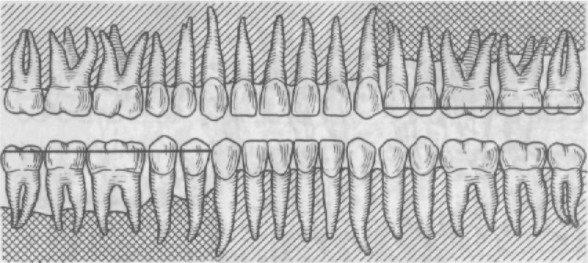 Фронтальная группа зубов рисунок