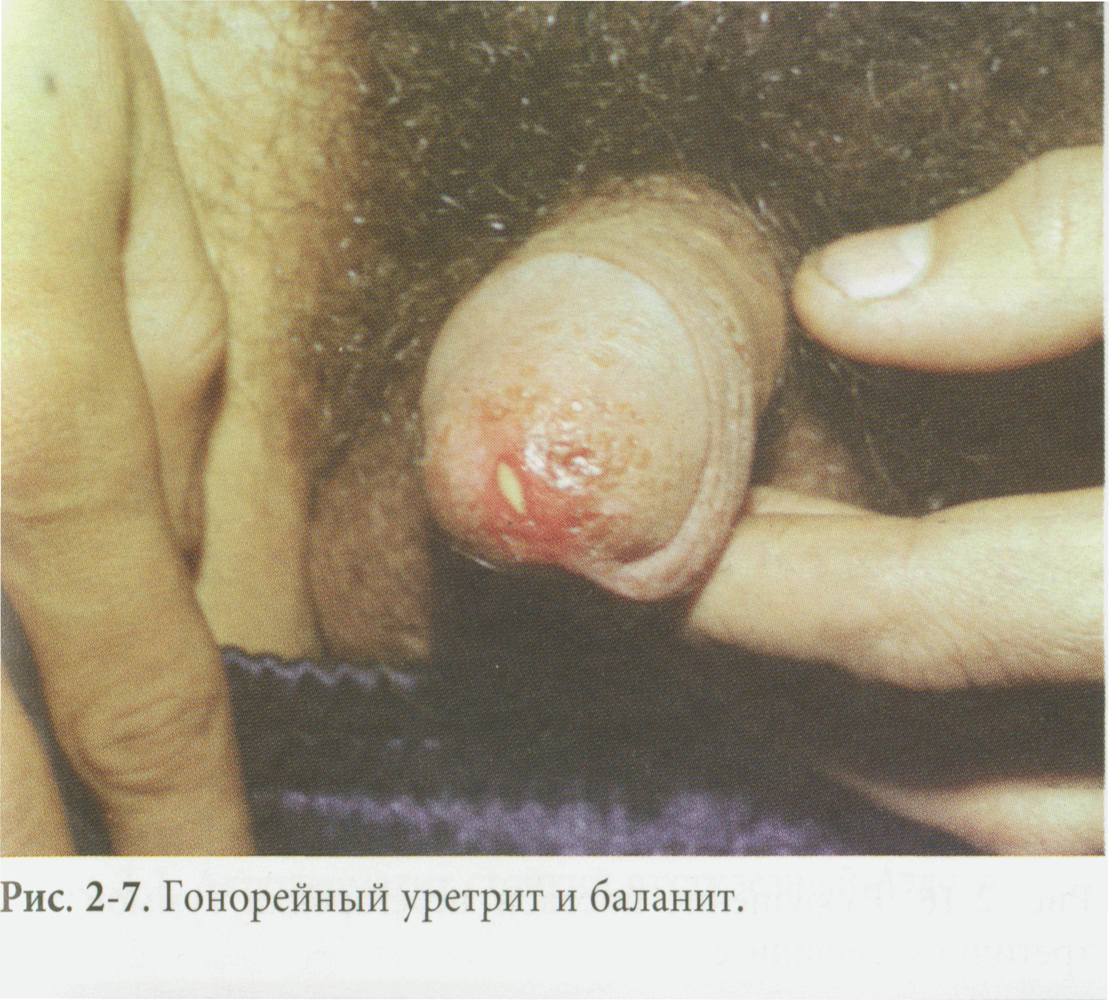 какие болезни передаются через минет у мужчин фото 37