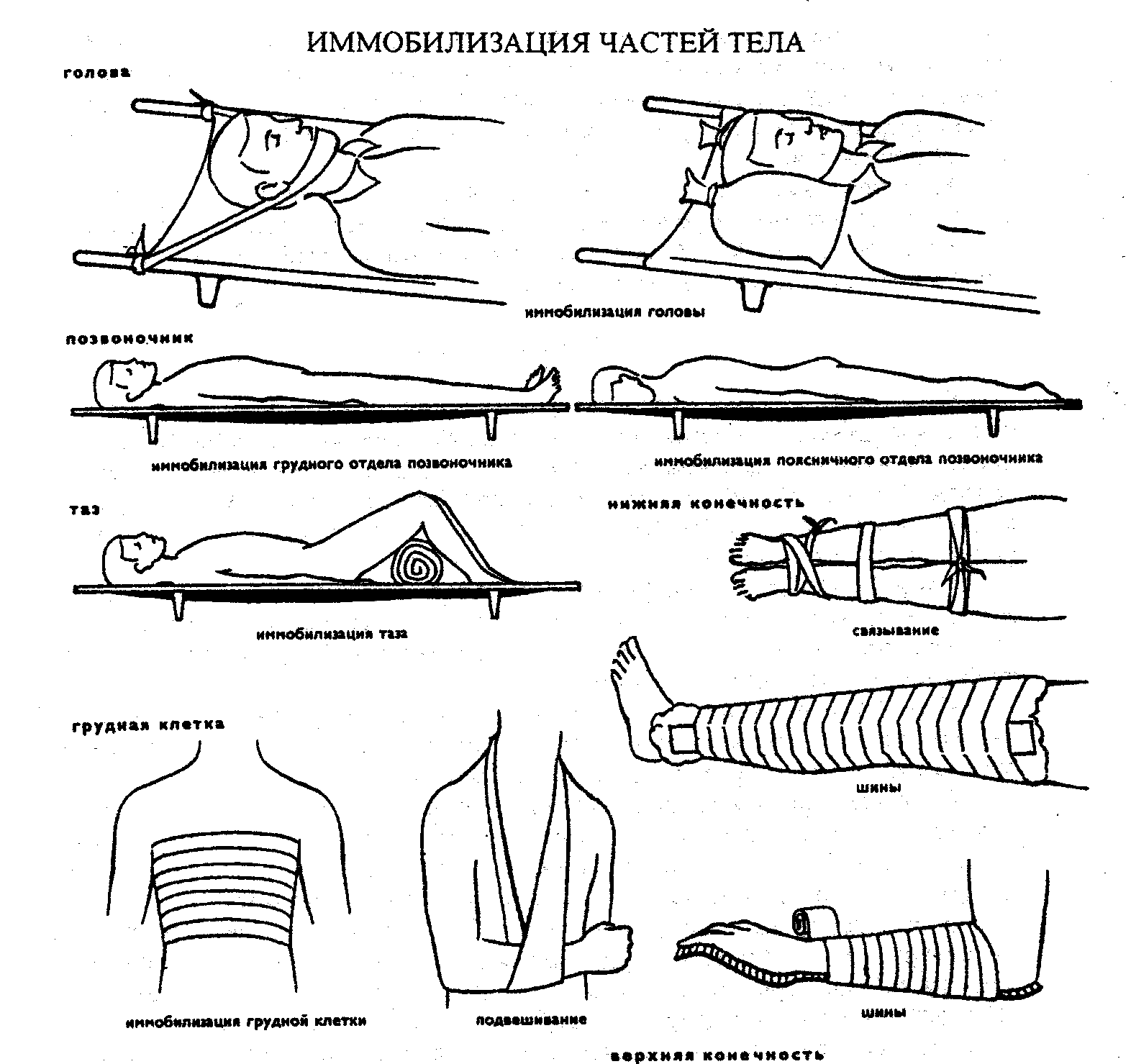 Транспортная иммобилизация