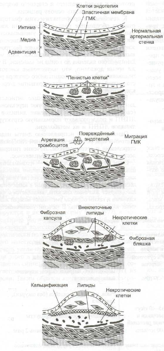 Молекулярные механизмы патогенеза атеросклероза thumbnail