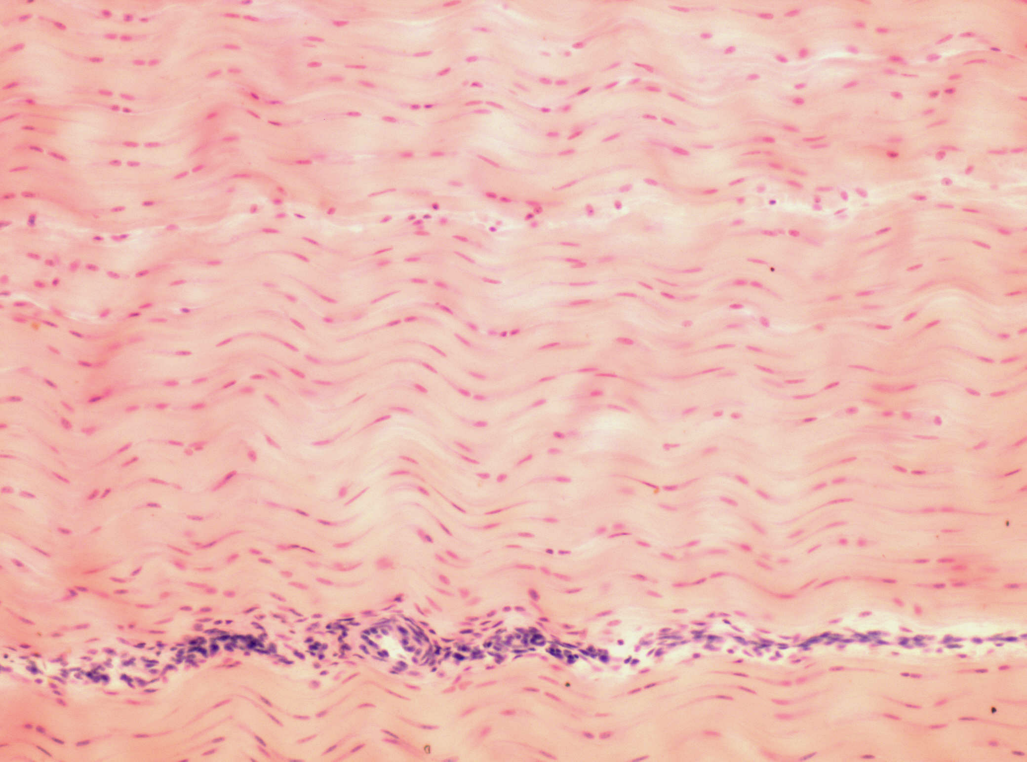 Плотная оформленная ткань сухожилия. Плотная соединительная ткань гистология. Плотная волокнистая соединительная ткань. Плотная оформленная соединительная ткань сухожилия гистология. Плотная оформленная соединительная ткань микропрепарат.