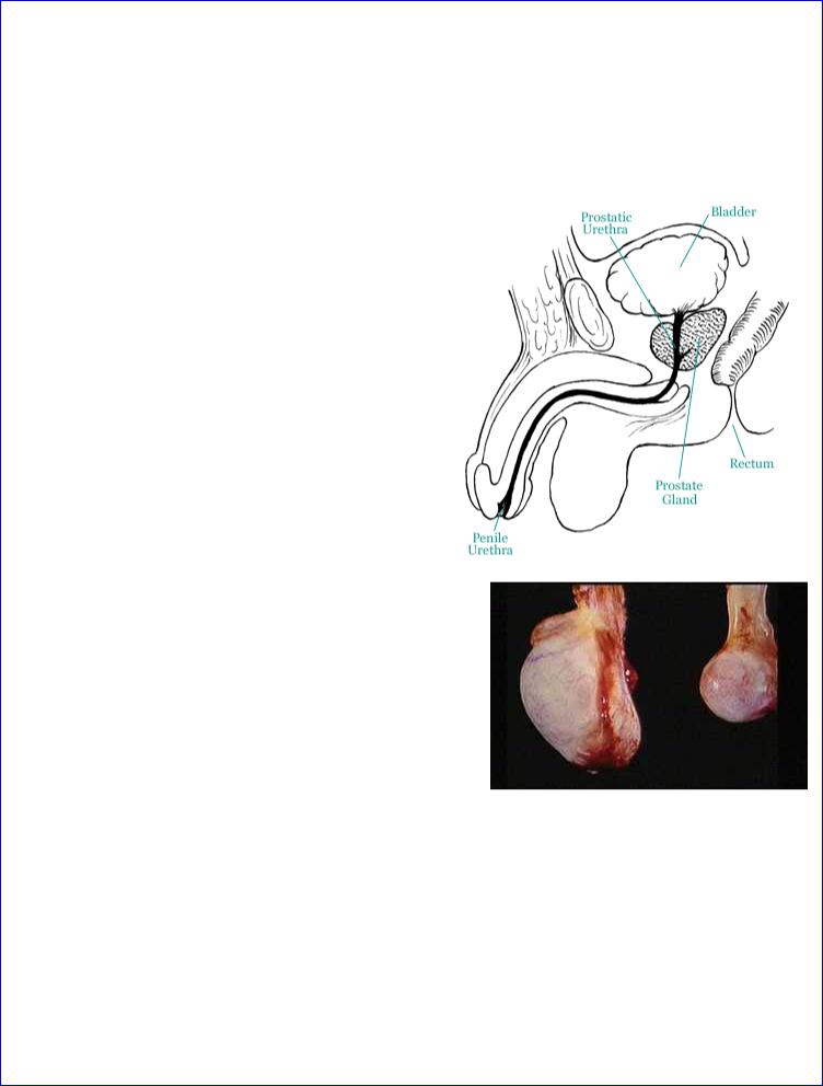 prostatitis fiatal