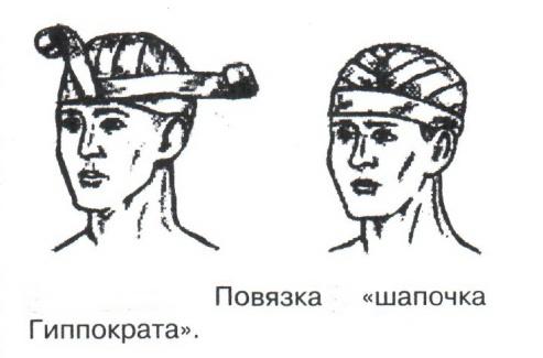 Техника наложения шапочки гиппократа