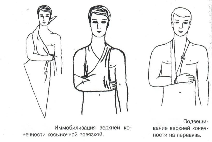 Шина воротник для иммобилизации