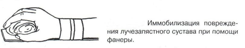 Понятие иммобилизация правила иммобилизации виды шин при переломах