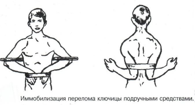 Понятие иммобилизация правила иммобилизации виды шин при переломах