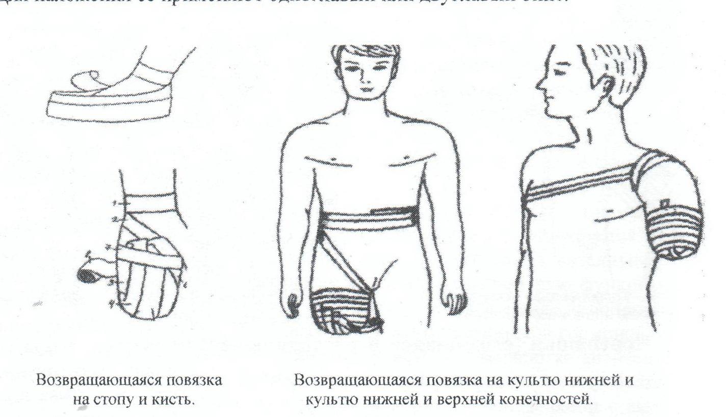 Требования к готовой повязке