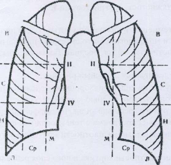 Сегменты границы. Рентгеноанатомия грудной клетки. Рентген грудной клетки сегменты. Ренгентанатомия лёгких. Грудная клетка рентген анатомия.