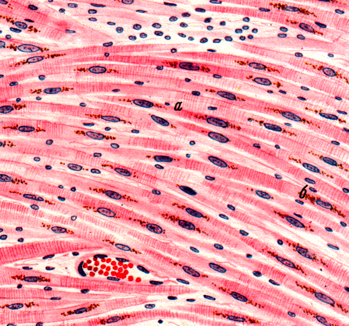 Гладкая мышечная ткань в дерме. Гладкая мышечная ткань микропрепарат. Гладкомышечная клетка гистология. Бурая атрофия миокарда микропрепарат. Клетки мышечной ткани гистология.