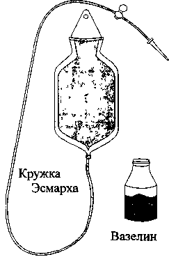 10. Набор для промывания желудка.