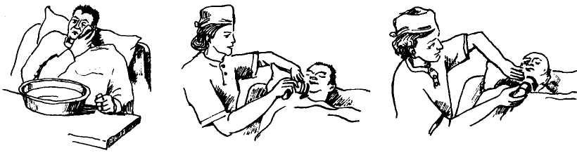 Как медсестра бреет перед операцией