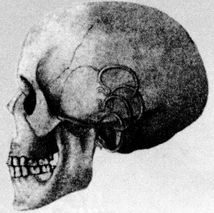 Височные завитки еврея. Славянская форма черепа. Форма черепа у евреев.
