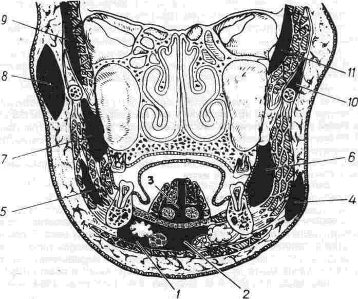 Пространства полости рта. Боковое окологлоточное пространство топография. Клетчаточные пространства дна ротовой полости. Флегмона окологлоточного пространства. Клетчаточное пространство дна полости рта анатомия.