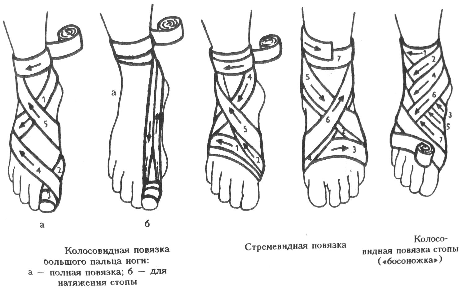 Схемы бинтования рук