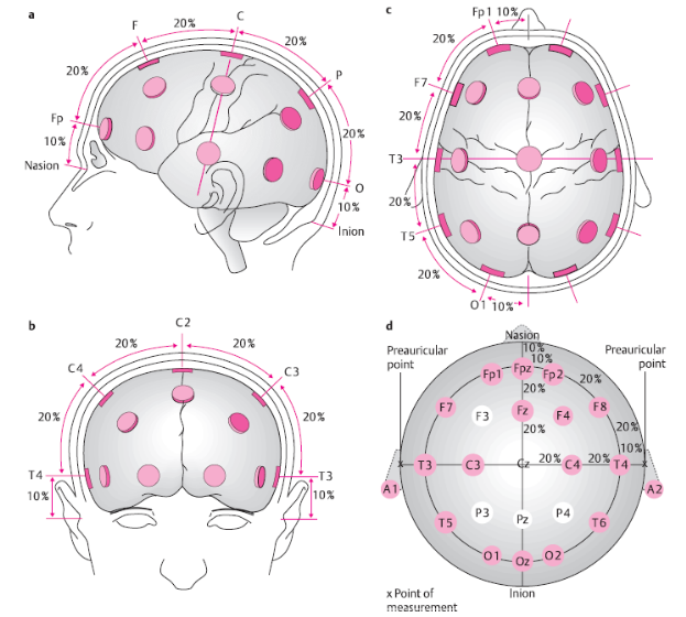 Схема 10 20 наложение электродов