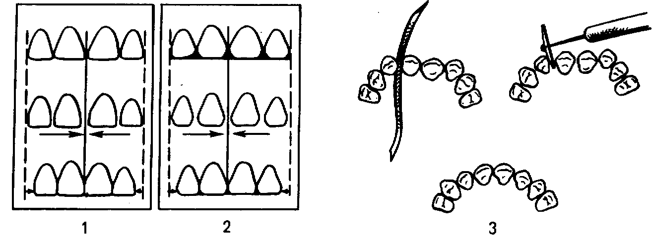 Форма зубных рядов