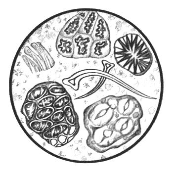 Растительная клетчатка непереваримая. Микроскопия кала растительная клетчатка непереваримая. Переваренная клетчатка микроскопия. Копрология растительная клетчатка перевариваемая. Преваваримая клетчатка в Кале.