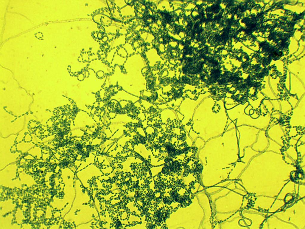 Актиномицеты фото под микроскопом