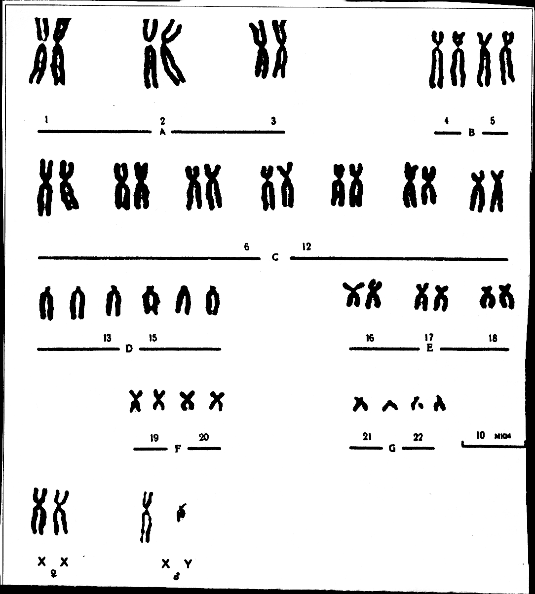 Диаграмма кариотипа человека