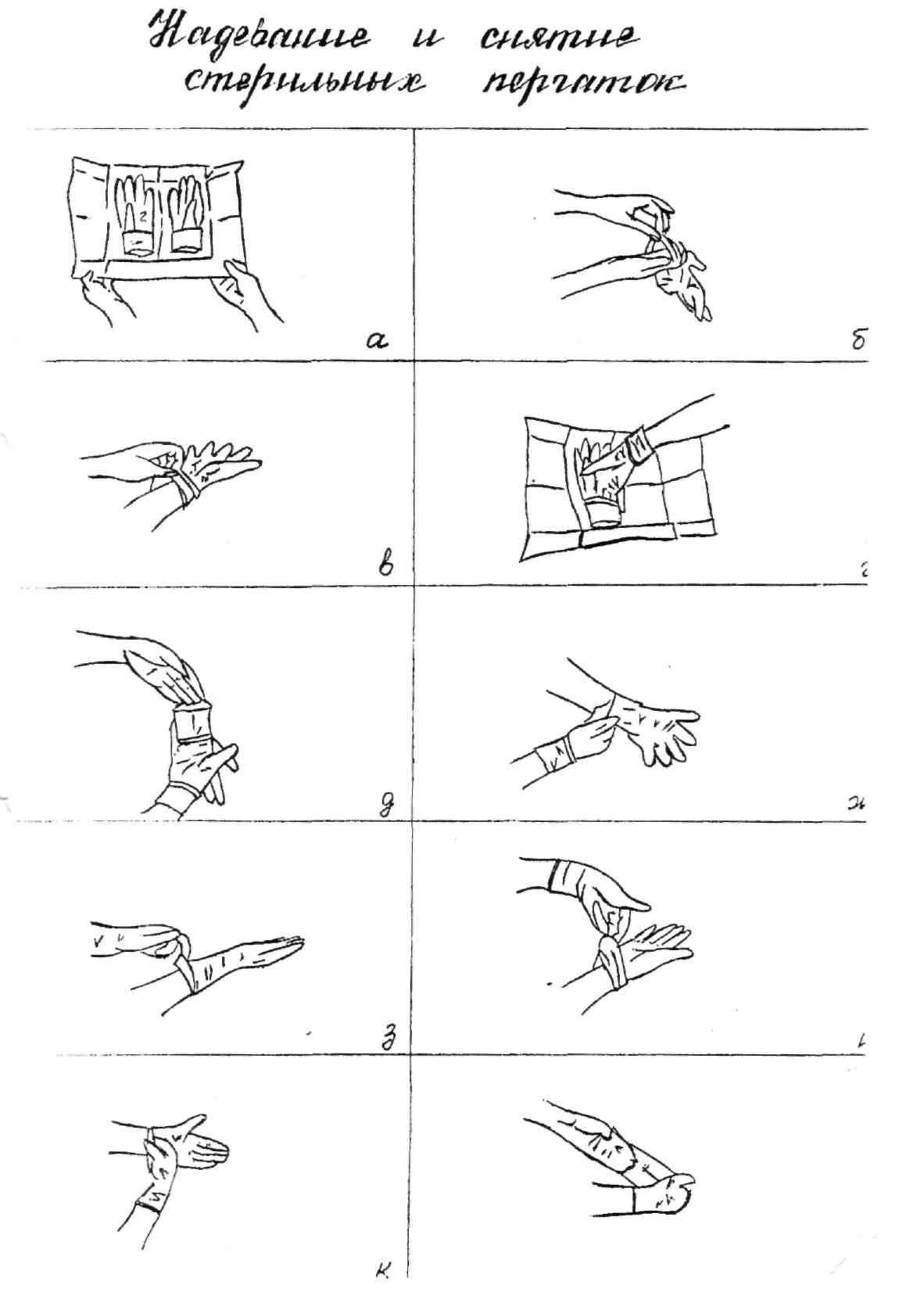 Алгоритм стерильных перчаток. Надевание стерильных перчаток. Техника надевания стерильных перчаток. Надевание и снимание стерильных перчаток. Схема снятия стерильных перчаток.